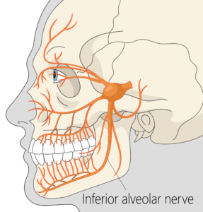 Inferior Alveolar Nerve