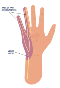 ulnar nerve