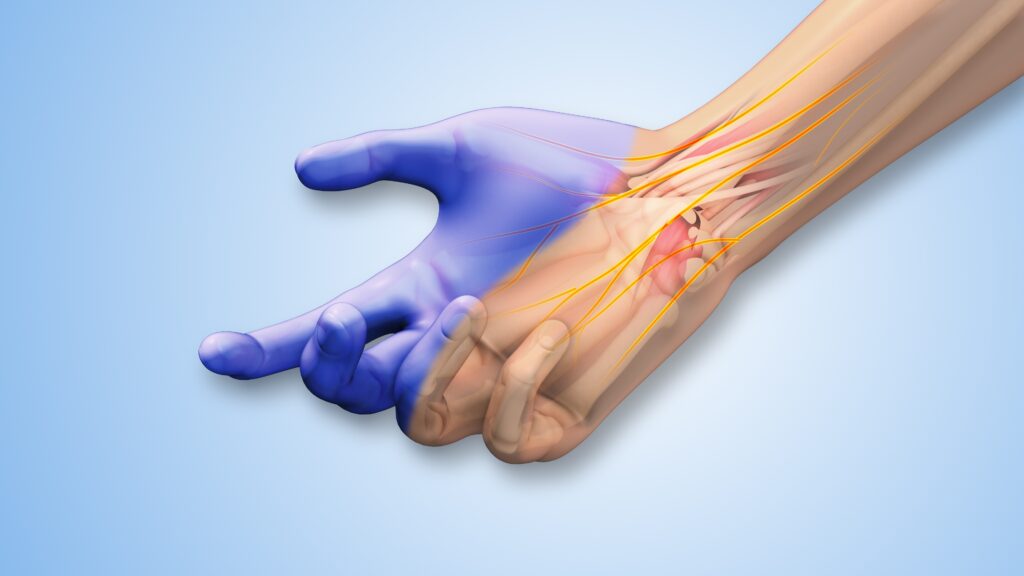 median nerve